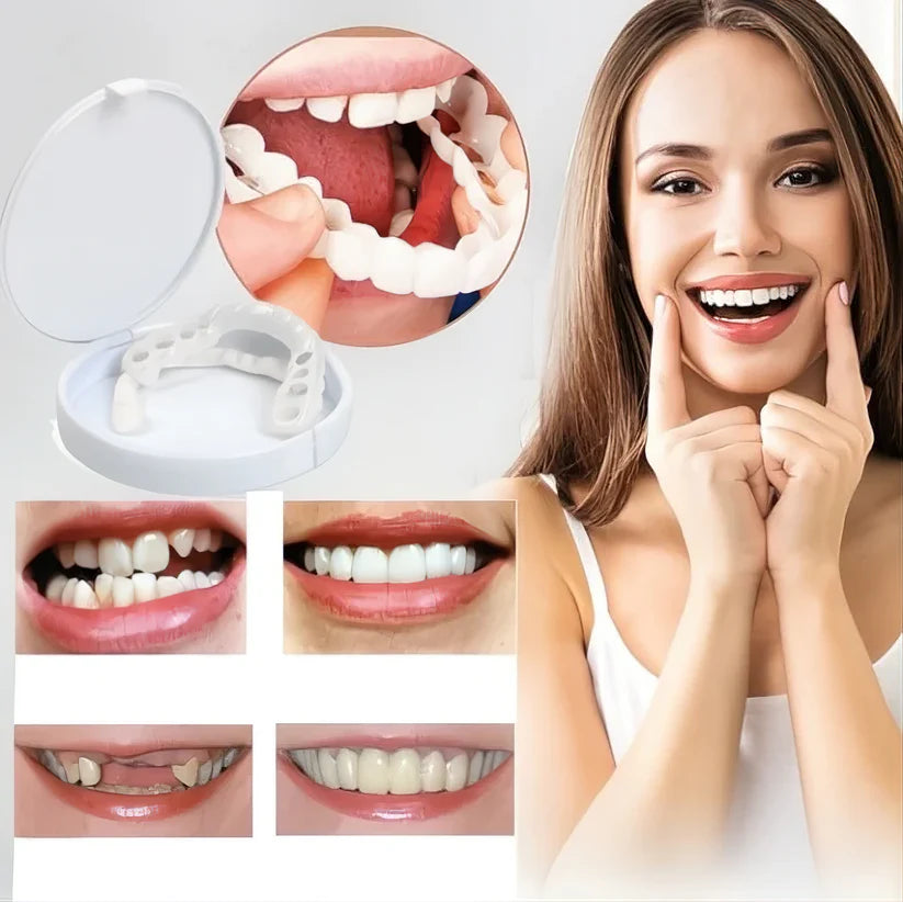 Lndmark Quick-Veneers