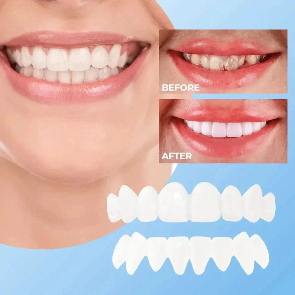 Lndmark Quick-Veneers