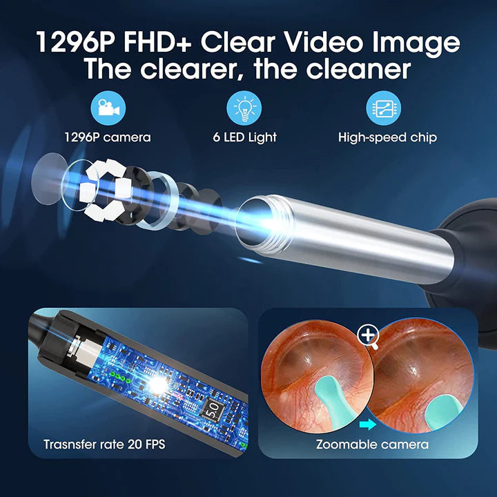 Earwax Removal Tool with Camera