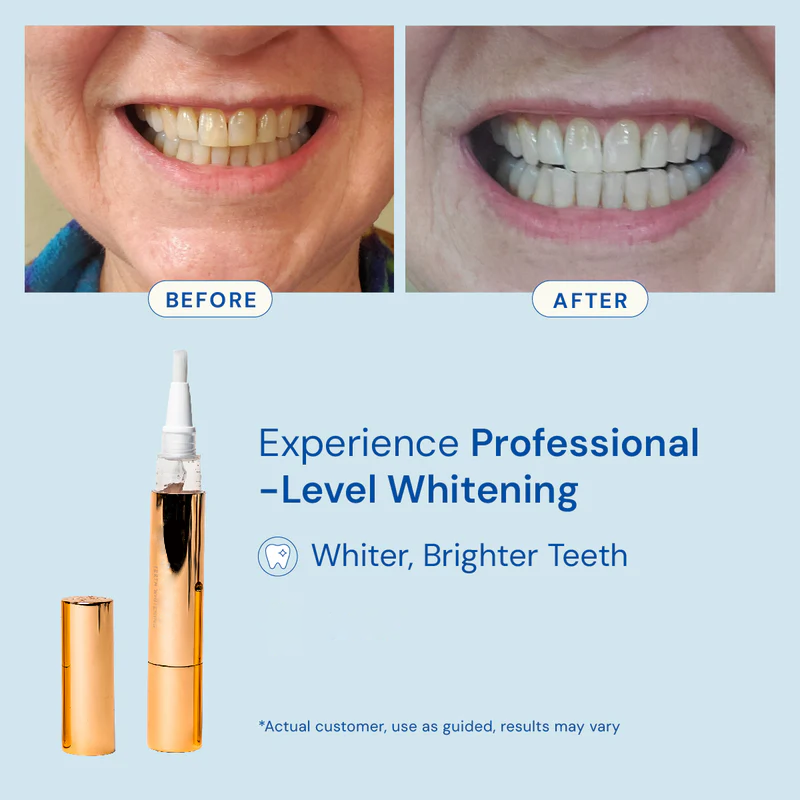 Dental Grade Teeth Whitening Serum