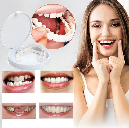 Lndmark Quick-Veneers