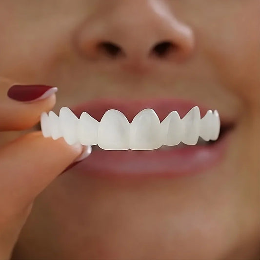 Lndmark Quick-Veneers